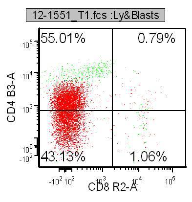 Figure 7a. Flow cytometry, Ethmoid sinus, CD4 dim
